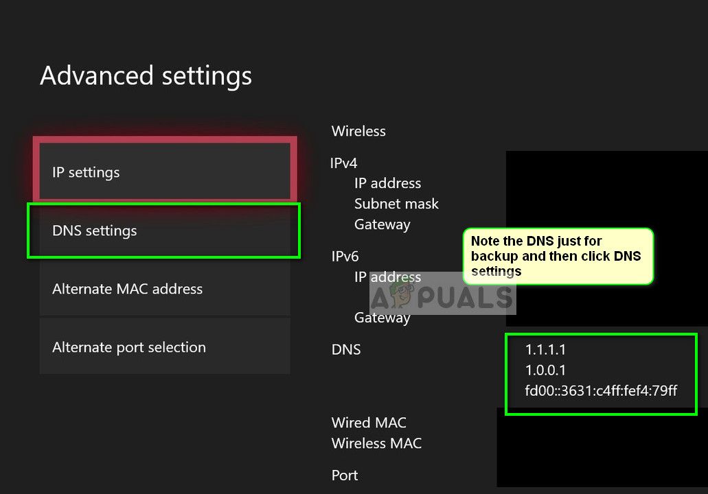 Настройки DNS в консоли Xbox