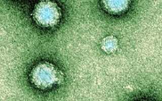 Что я могу сделать, чтобы защитить мой компьютер без антивирусного программного обеспечения?